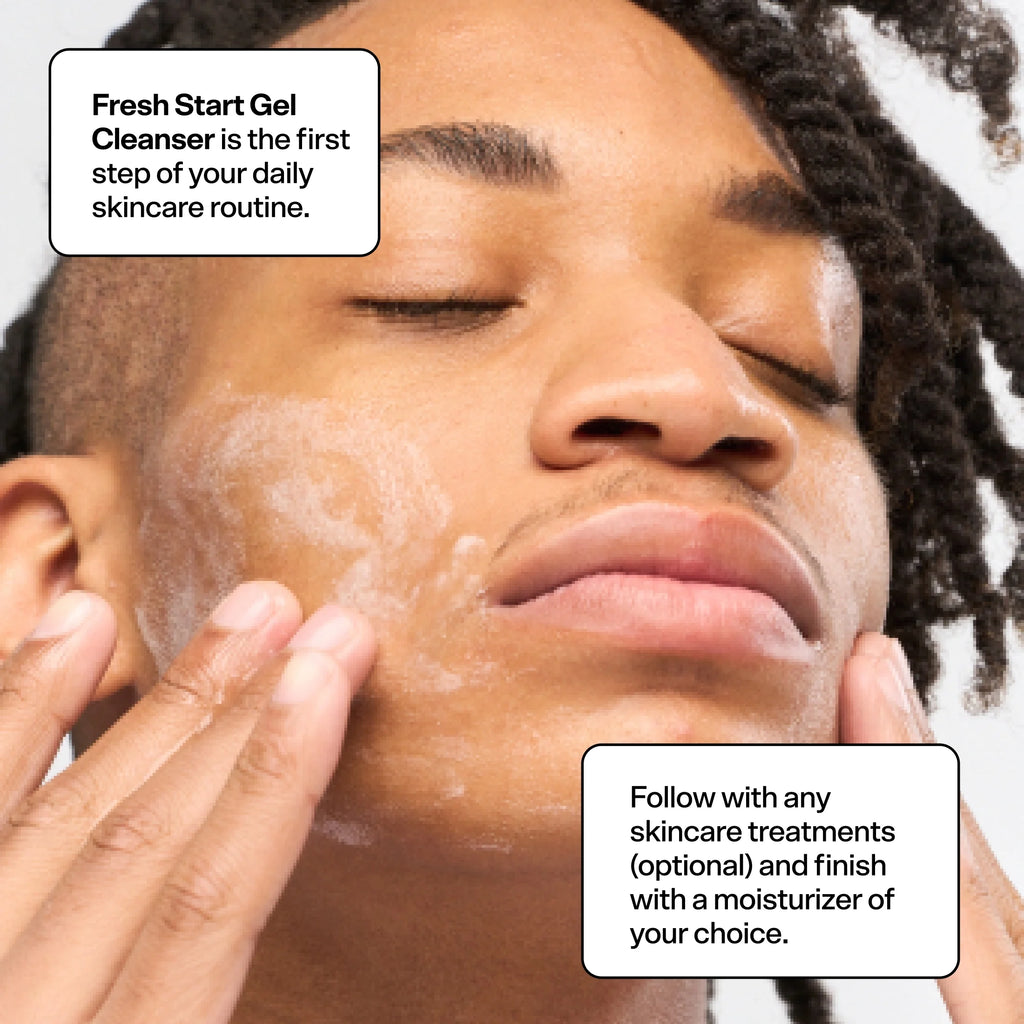 Acne Kit for All Skin Types, 3 Items Z5395