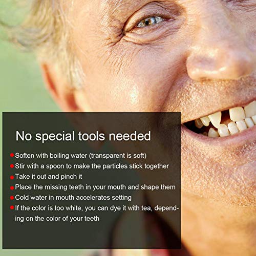 Teeth Repair Beads for Missing Tooth Filling, 10g I140